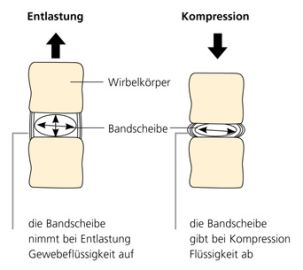 Bandscheiben Grafik